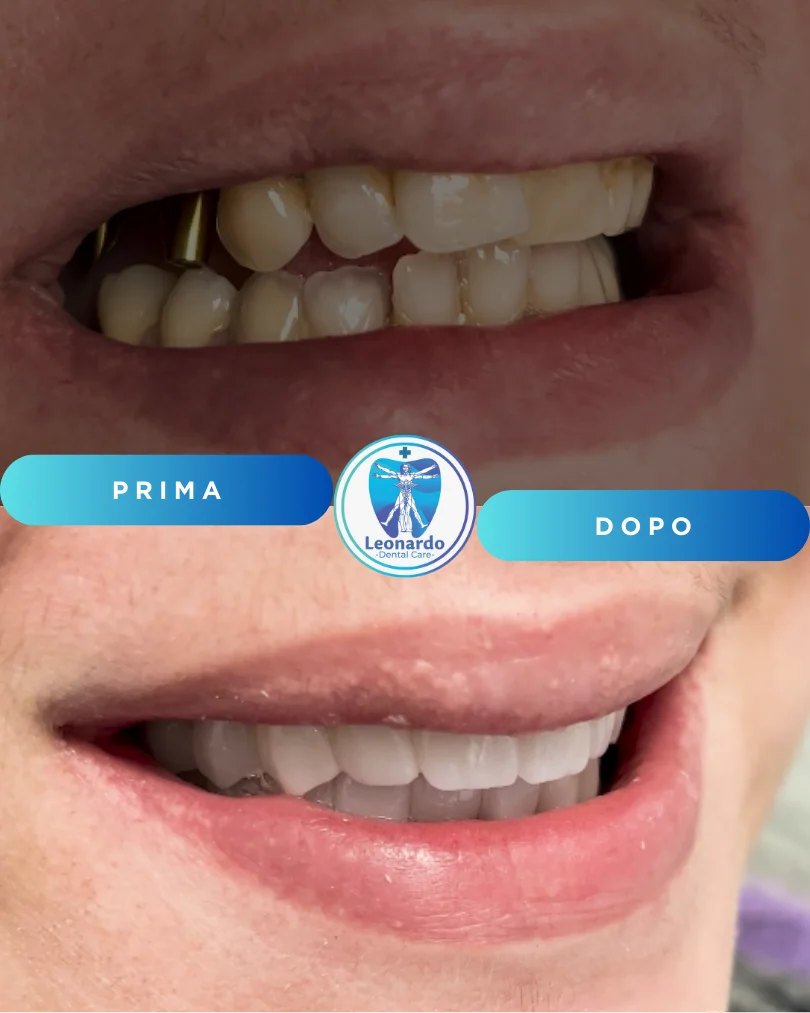 Prima e Dopo 3