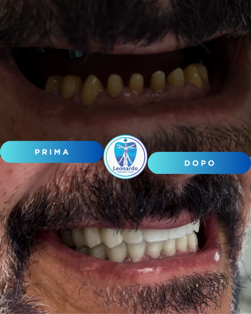 Prima e Dopo 4